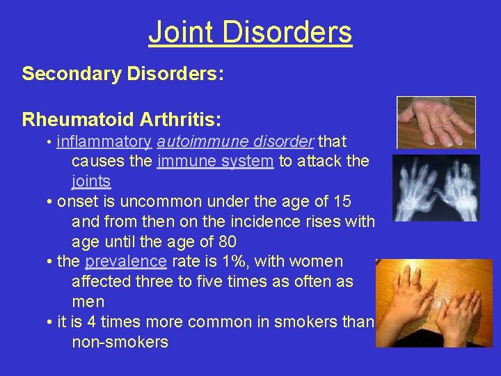 Joint Disorders Secondary Disorders: Rheumatoid Arthritis: • inflammatory autoimmune disorder that causes the immune