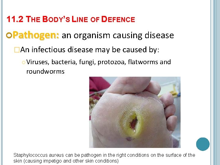 11. 2 THE BODY’S LINE OF DEFENCE Pathogen: an organism causing disease �An infectious