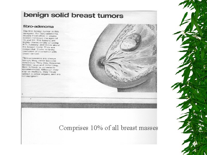 Comprises 10% of all breast masses 