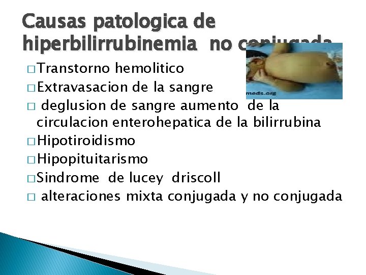 Causas patologica de hiperbilirrubinemia no conjugada � Transtorno hemolitico � Extravasacion de la sangre