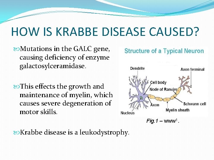 HOW IS KRABBE DISEASE CAUSED? Mutations in the GALC gene, causing deficiency of enzyme