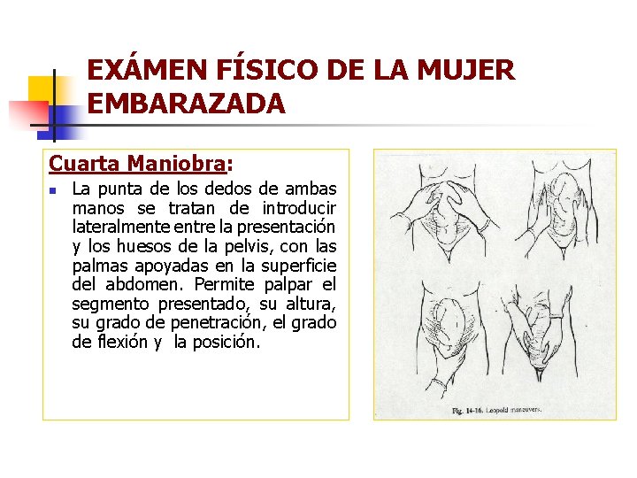 EXÁMEN FÍSICO DE LA MUJER EMBARAZADA Cuarta Maniobra: n La punta de los dedos