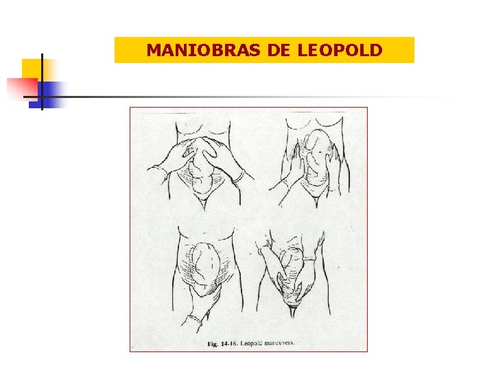 MANIOBRAS DE LEOPOLD 