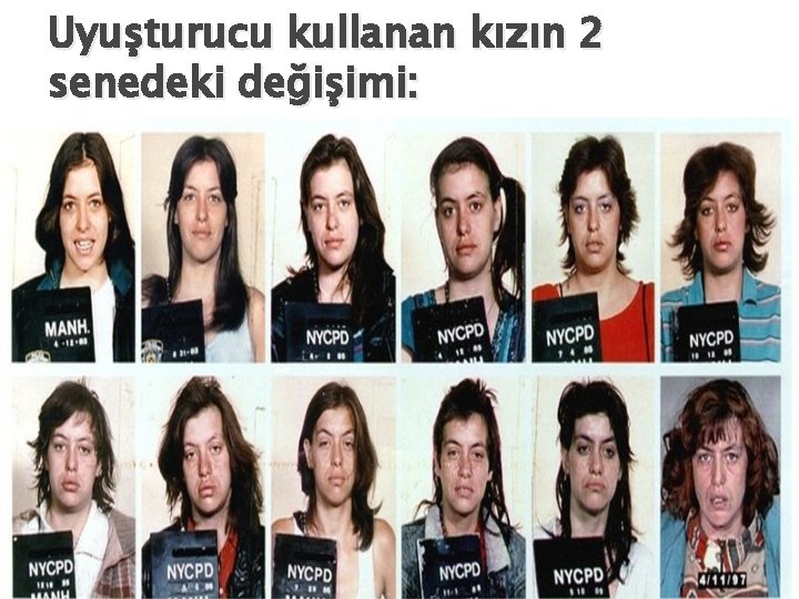 Uyuşturucu kullanan kızın 2 senedeki değişimi: 