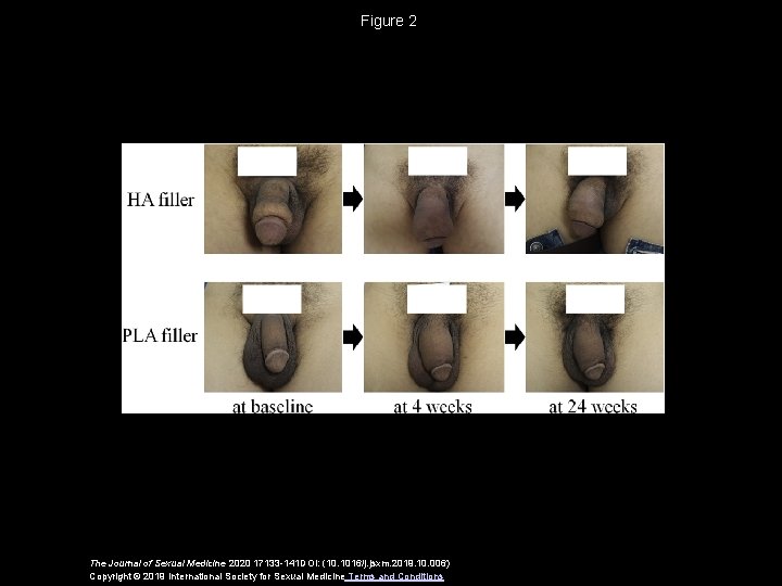 Figure 2 The Journal of Sexual Medicine 2020 17133 -141 DOI: (10. 1016/j. jsxm.