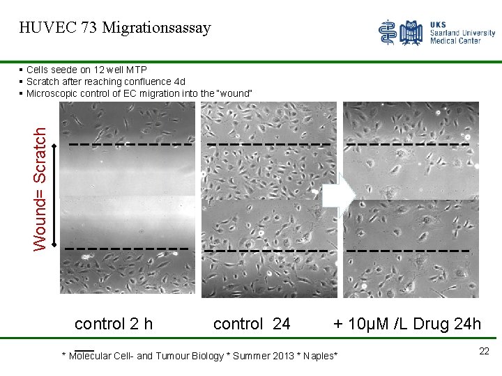 HUVEC 73 Migrationsassay Wound= Scratch § Cells seede on 12 well MTP § Scratch