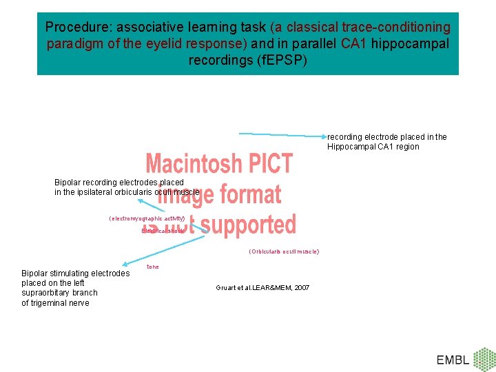 Procedure: associative learning task (a classical trace-conditioning paradigm of the eyelid response) and in
