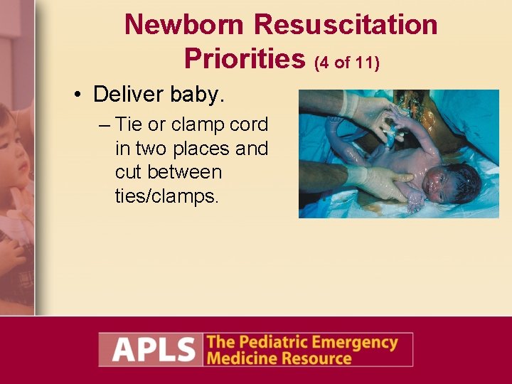 Newborn Resuscitation Priorities (4 of 11) • Deliver baby. – Tie or clamp cord