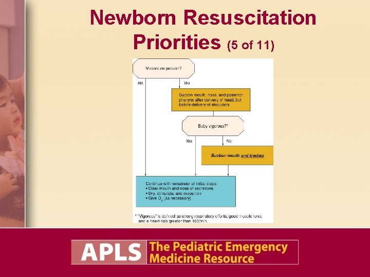 Newborn Resuscitation Priorities (5 of 11) 