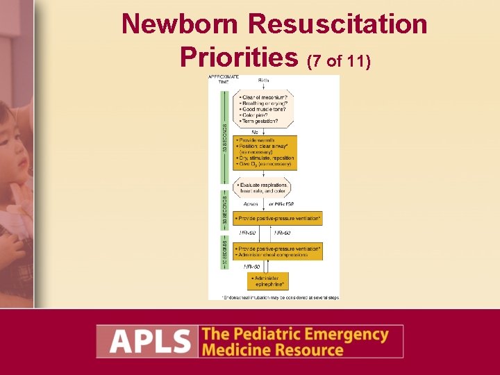 Newborn Resuscitation Priorities (7 of 11) Newborn Resuscitation Priorities (7 of 11)