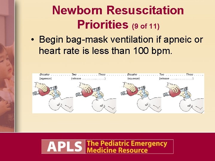 Newborn Resuscitation Priorities (9 of 11) • Begin bag-mask ventilation if apneic or heart