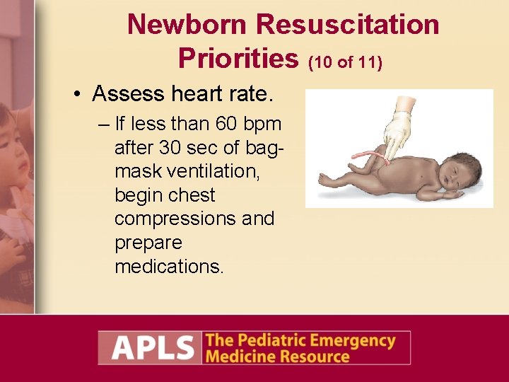 Newborn Resuscitation Priorities (10 of 11) • Assess heart rate. – If less than