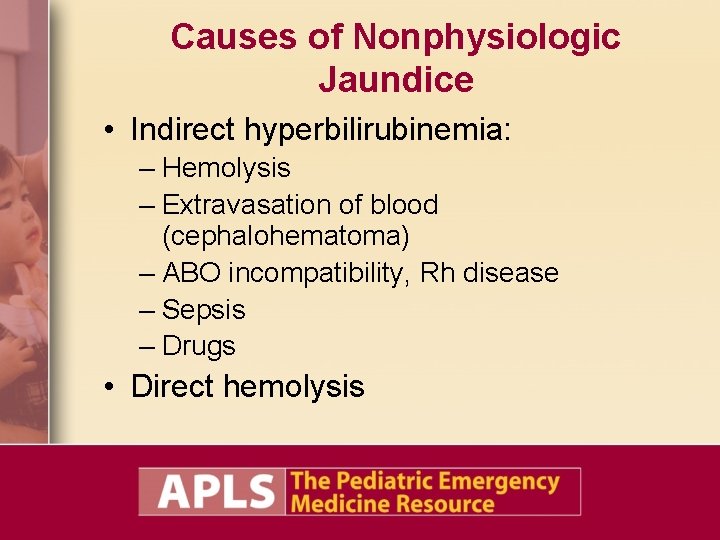 Causes of Nonphysiologic Jaundice • Indirect hyperbilirubinemia: – Hemolysis – Extravasation of blood (cephalohematoma) Causes of Nonphysiologic Jaundice • Indirect hyperbilirubinemia: – Hemolysis – Extravasation of blood (cephalohematoma)