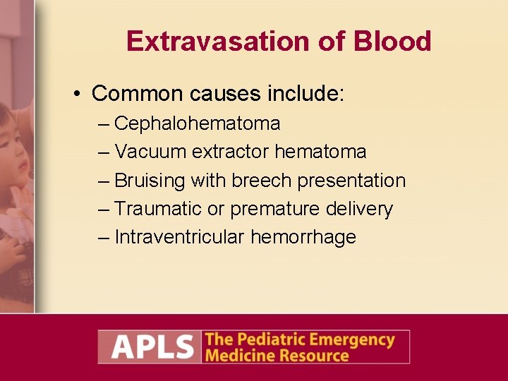 Extravasation of Blood • Common causes include: – Cephalohematoma – Vacuum extractor hematoma –