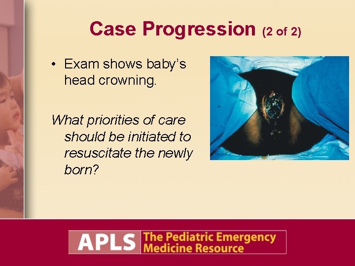 Case Progression (2 of 2) • Exam shows baby’s head crowning. What priorities of