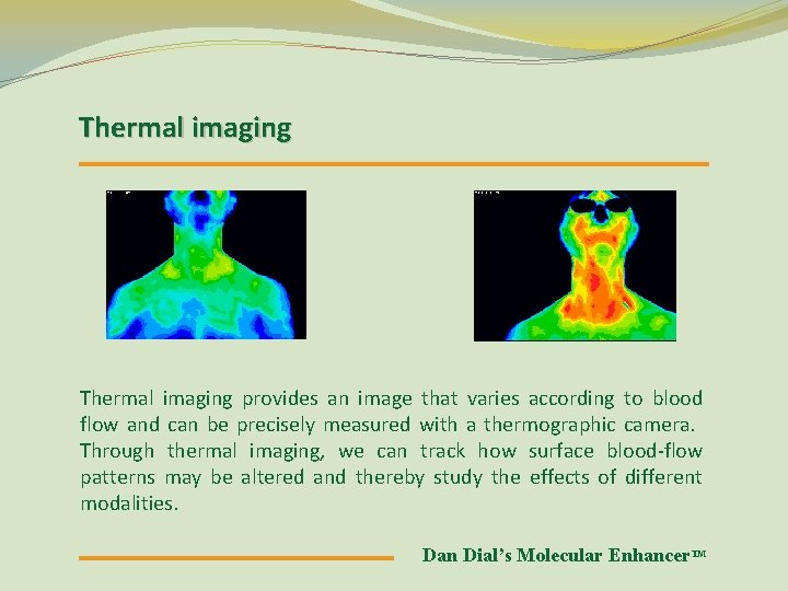 Thermal imaging provides an image that varies according to blood flow and can be