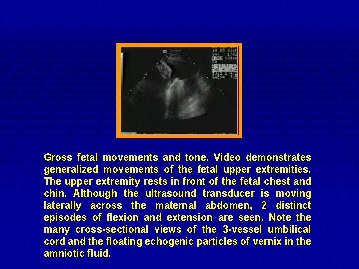 Gross fetal movements and tone. Video demonstrates generalized movements of the fetal upper extremities.