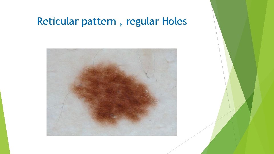 Reticular pattern , regular Holes 