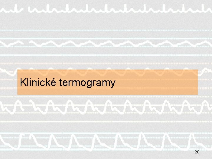 Klinické termogramy 20 