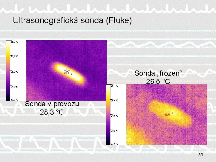 Ultrasonografická sonda (Fluke) Sonda „frozen“ 26, 5 °C Sonda v provozu 28, 3 °C