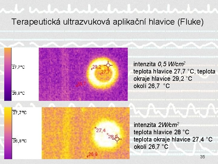 Terapeutická ultrazvuková aplikační hlavice (Fluke) intenzita 0, 5 W/cm 2 teplota hlavice 27, 7