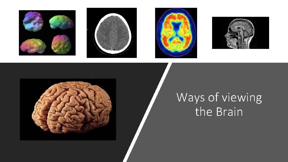 Ways of viewing the Brain 