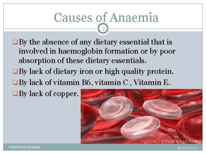 Causes of Anaemia 3 q. By the absence of any dietary essential that is