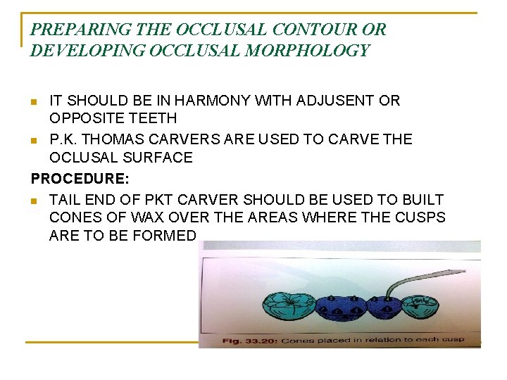 PREPARING THE OCCLUSAL CONTOUR OR DEVELOPING OCCLUSAL MORPHOLOGY IT SHOULD BE IN HARMONY WITH