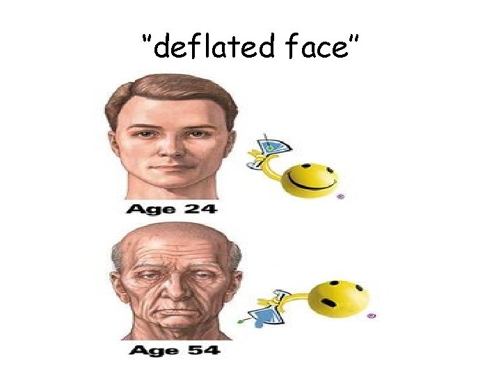‘’deflated face’’ 