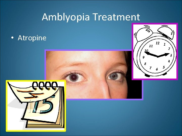 Amblyopia Treatment • Atropine 