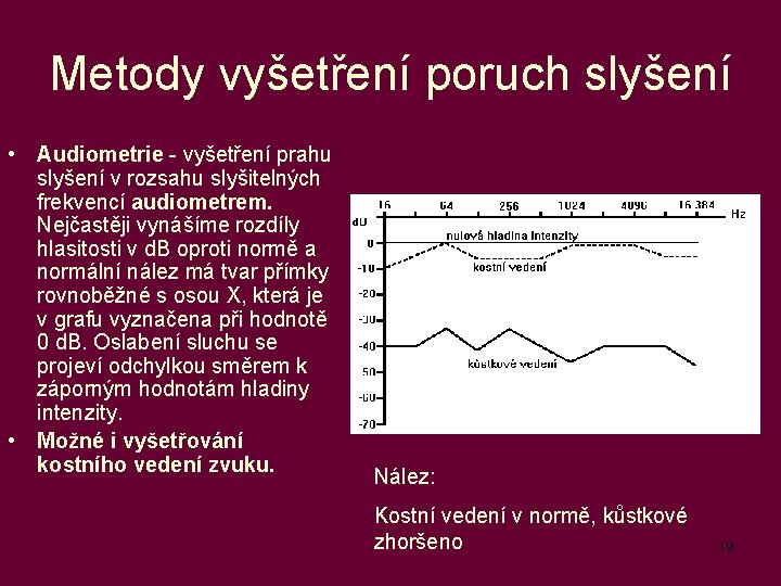 Metody vyšetření poruch slyšení • Audiometrie - vyšetření prahu slyšení v rozsahu slyšitelných frekvencí