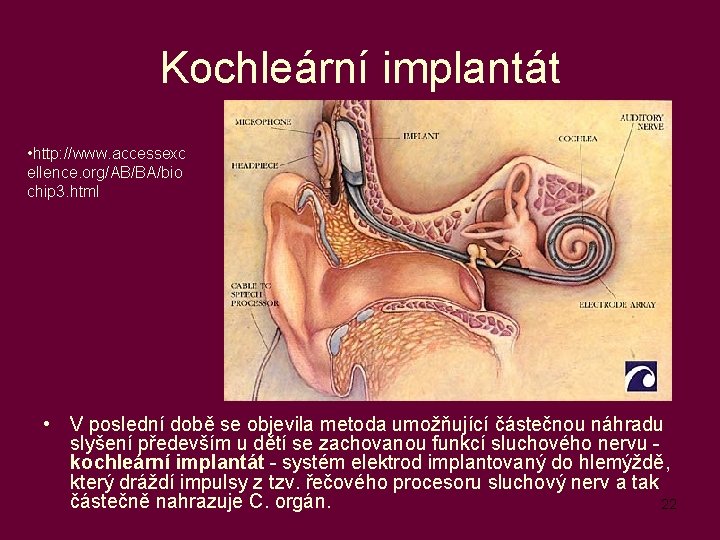 Kochleární implantát • http: //www. accessexc ellence. org/AB/BA/bio chip 3. html • V poslední