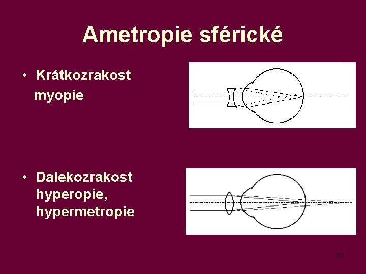 Ametropie sférické • Krátkozrakost myopie • Dalekozrakost hyperopie, hypermetropie 37 