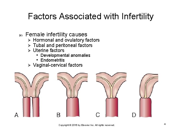 Factors Associated with Infertility Female infertility causes Ø Ø Ø Hormonal and ovulatory factors
