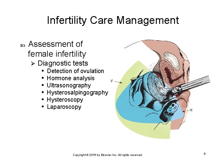 Infertility Care Management Assessment of female infertility Ø Diagnostic tests • Detection of ovulation
