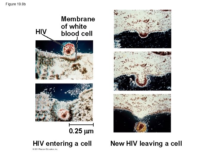 Figure 19. 8 b HIV Membrane of white blood cell 0. 25 m HIV