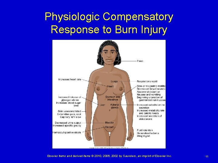 Physiologic Compensatory Response to Burn Injury Elsevier items and derived items © 2010, 2006,