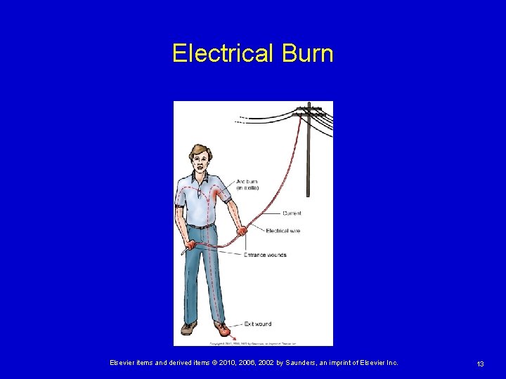 Electrical Burn Elsevier items and derived items © 2010, 2006, 2002 by Saunders, an