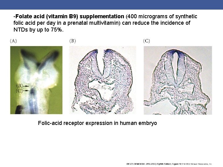 -Folate acid (vitamin B 9) supplementation (400 micrograms of synthetic folic acid per day