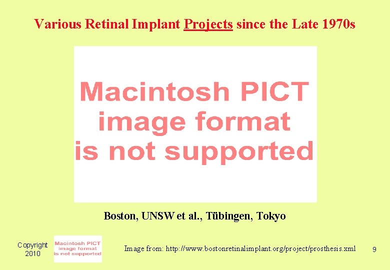 Various Retinal Implant Projects since the Late 1970 s Boston, UNSW et al. ,