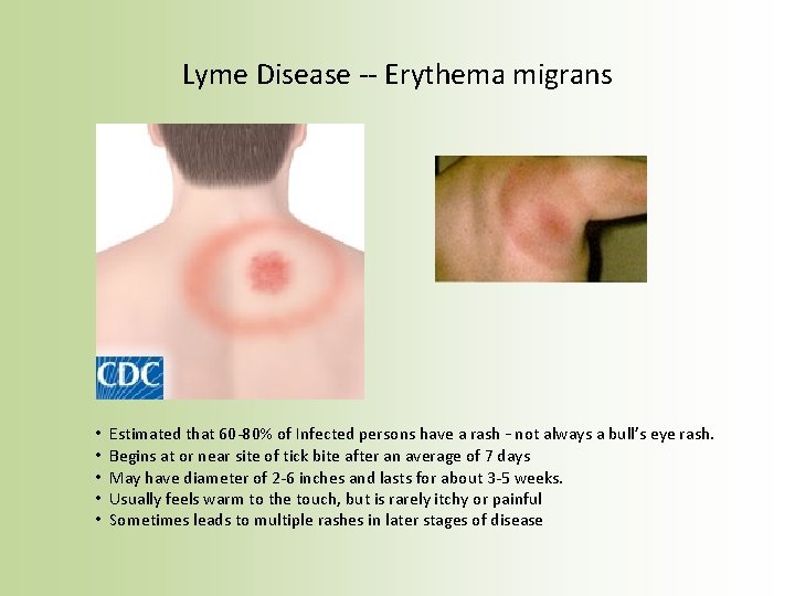Lyme Disease -- Erythema migrans • • • Estimated that 60 -80% of Infected