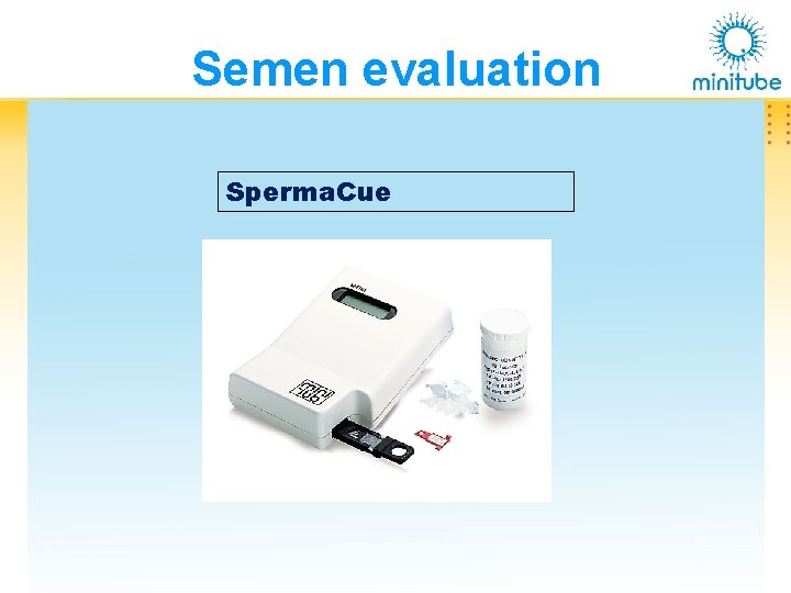 Semen evaluation Sperma. Cue 
