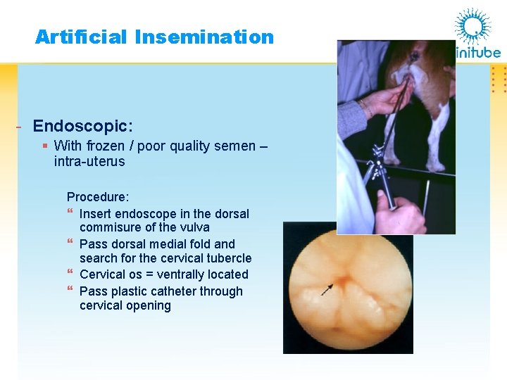 Artificial Insemination - Endoscopic: § With frozen / poor quality semen – intra-uterus Procedure: