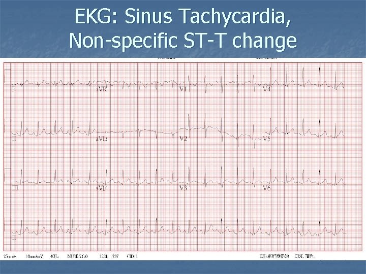 EKG: Sinus Tachycardia, Non-specific ST-T change 