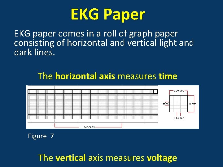 EKG Paper EKG paper comes in a roll of graph paper consisting of horizontal