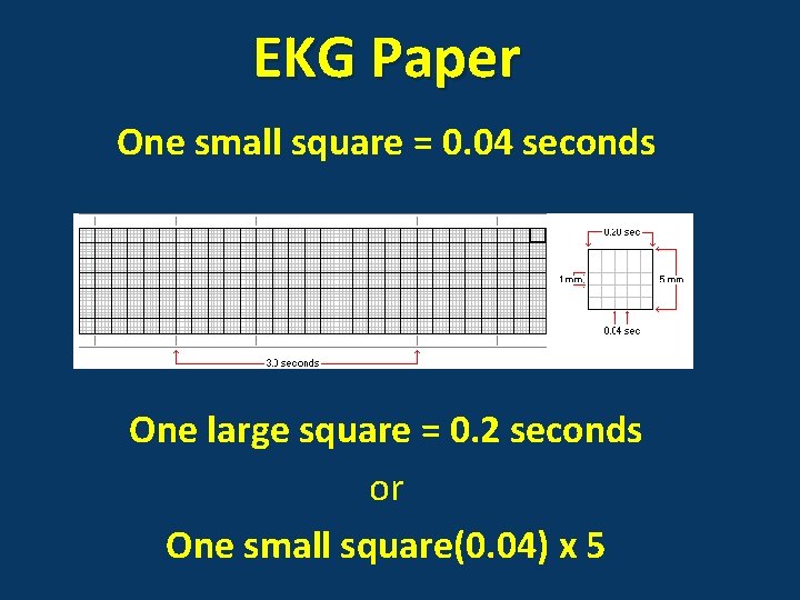 EKG Paper One small square = 0. 04 seconds One large square = 0.