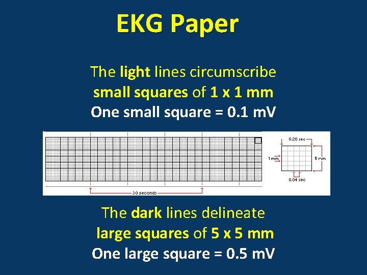 EKG Paper The light lines circumscribe small squares of 1 x 1 mm One