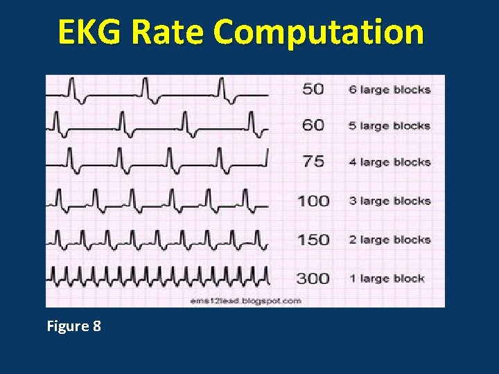 EKG Rate Computation Figure 8 