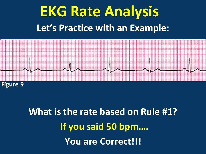 EKG Rate Analysis Let’s Practice with an Example: Figure 9 What is the rate