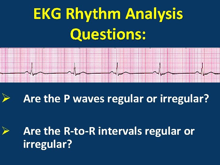EKG Rhythm Analysis Questions: Ø Are the P waves regular or irregular? Ø Are